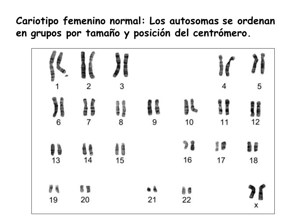 Cariotipo femenino normal: Los autosomas se ordenan en grupos por tamaño y posición del centrómero.