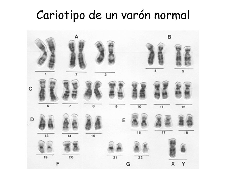 Cariotipo de un varón normal