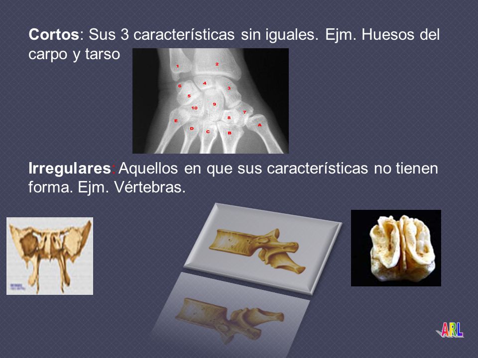 Cortos: Sus 3 características sin iguales. Ejm