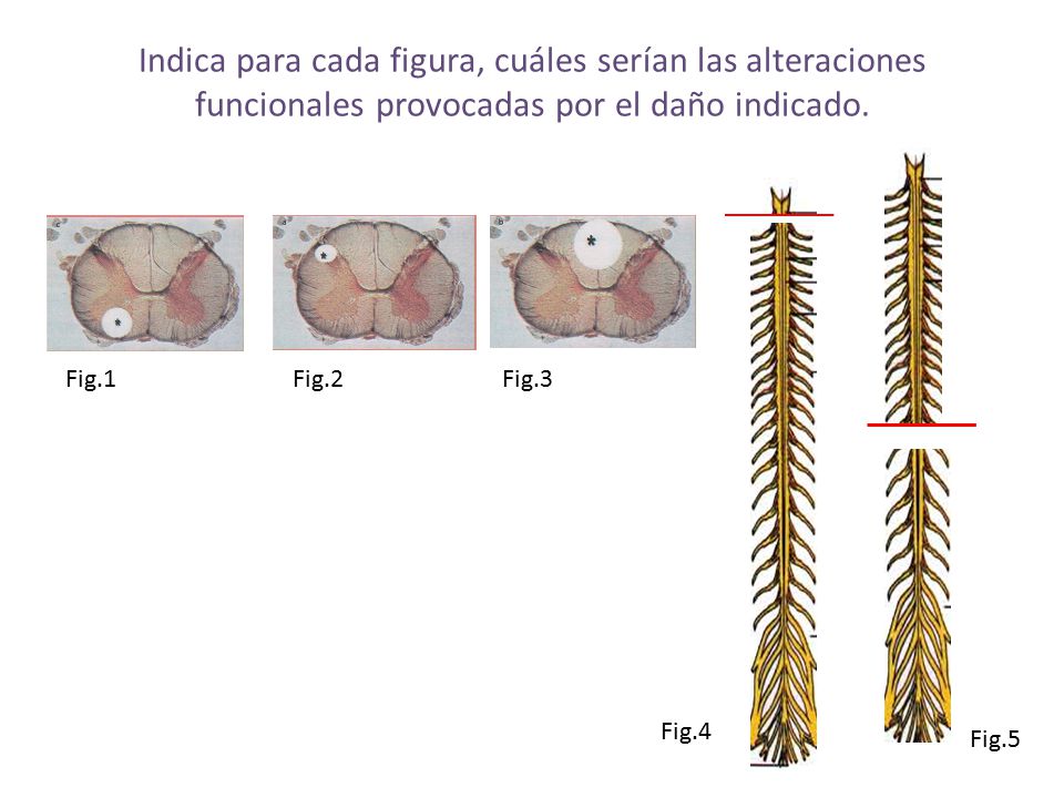 Indica para cada figura, cuáles serían las alteraciones funcionales provocadas por el daño indicado.