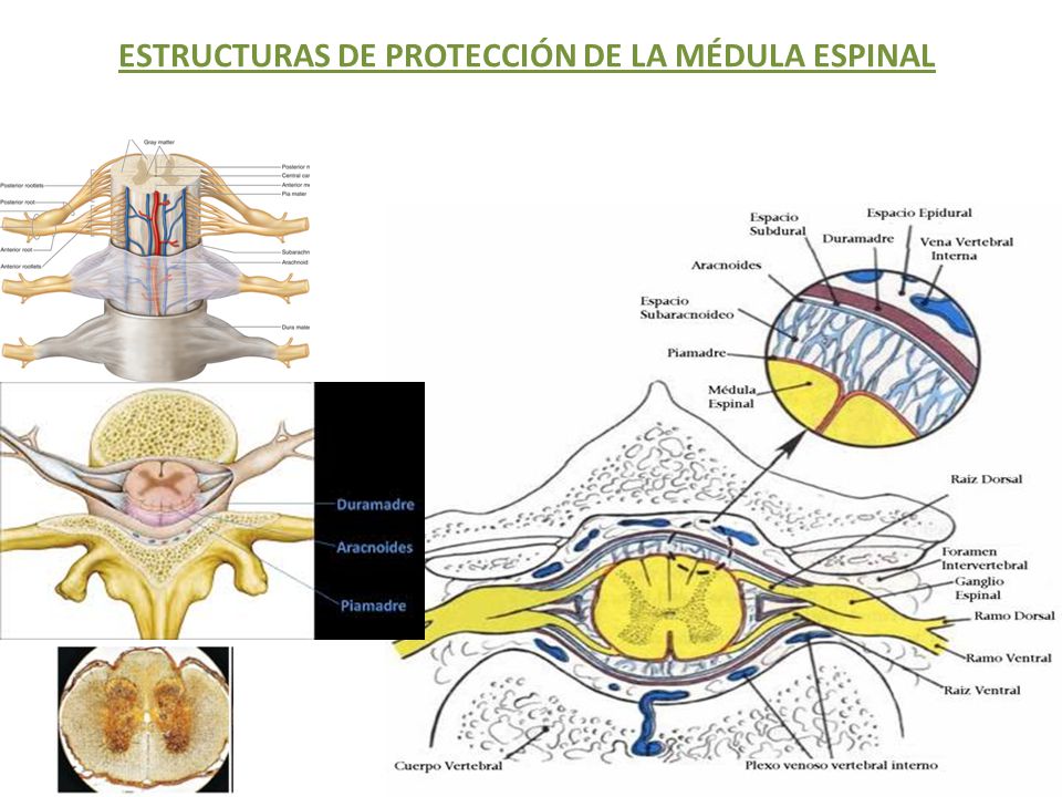 ESTRUCTURAS DE PROTECCIÓN DE LA MÉDULA ESPINAL
