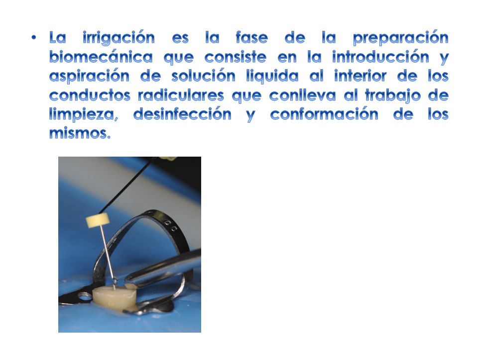 La irrigación es la fase de la preparación biomecánica que consiste en la introducción y aspiración de solución liquida al interior de los conductos radiculares que conlleva al trabajo de limpieza, desinfección y conformación de los mismos.