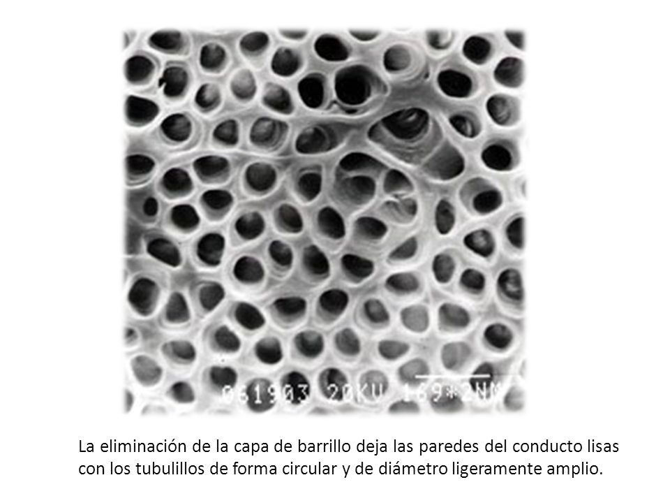 La eliminación de la capa de barrillo deja las paredes del conducto lisas con los tubulillos de forma circular y de diámetro ligeramente amplio.