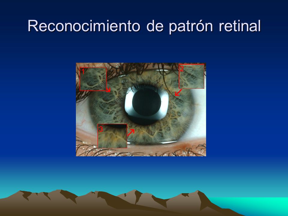 Reconocimiento de patrón retinal