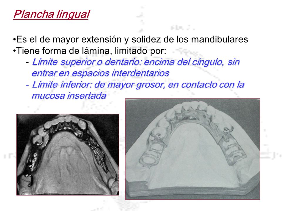 Plancha lingual Es el de mayor extensión y solidez de los mandibulares