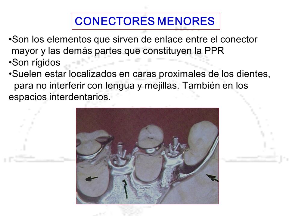 CONECTORES MENORES Son los elementos que sirven de enlace entre el conector. mayor y las demás partes que constituyen la PPR.