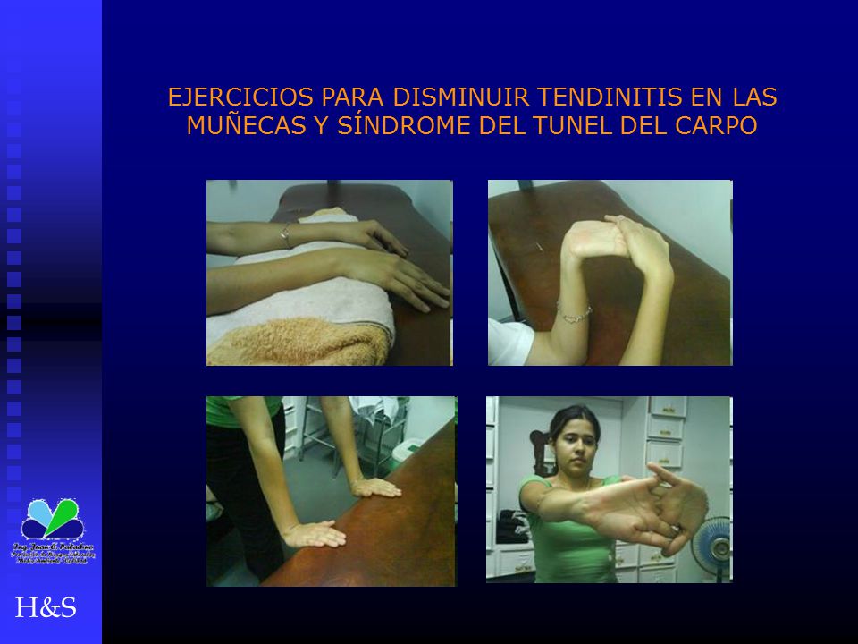 EJERCICIOS PARA DISMINUIR TENDINITIS EN LAS MUÑECAS Y SÍNDROME DEL TUNEL DEL CARPO