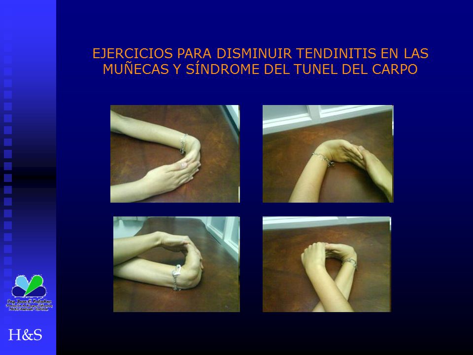 EJERCICIOS PARA DISMINUIR TENDINITIS EN LAS MUÑECAS Y SÍNDROME DEL TUNEL DEL CARPO
