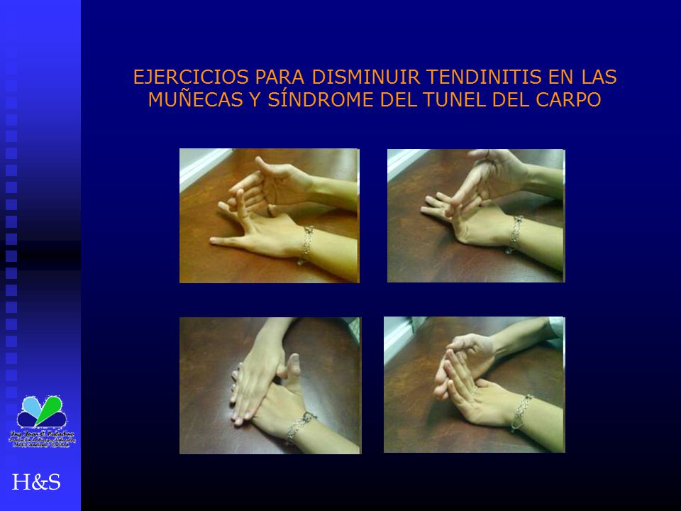 EJERCICIOS PARA DISMINUIR TENDINITIS EN LAS MUÑECAS Y SÍNDROME DEL TUNEL DEL CARPO