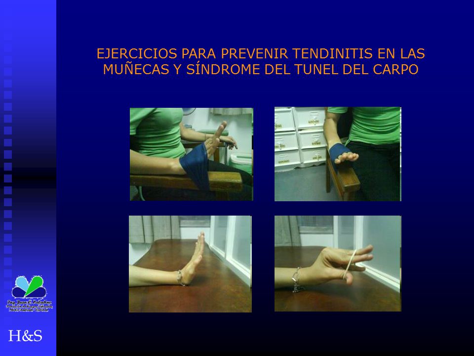EJERCICIOS PARA PREVENIR TENDINITIS EN LAS MUÑECAS Y SÍNDROME DEL TUNEL DEL CARPO