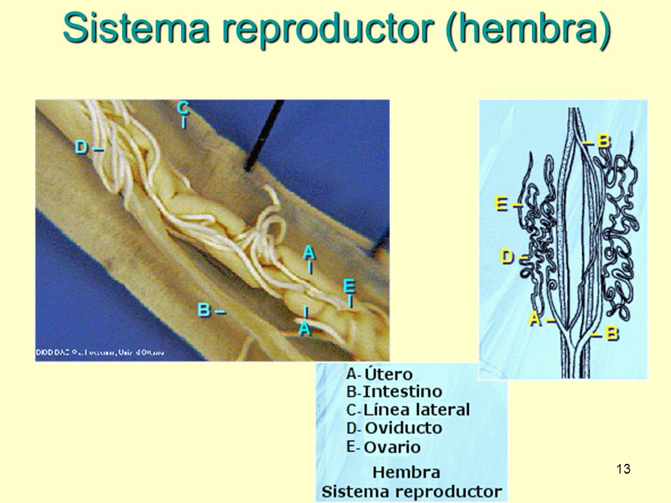 Sistema reproductor (hembra)