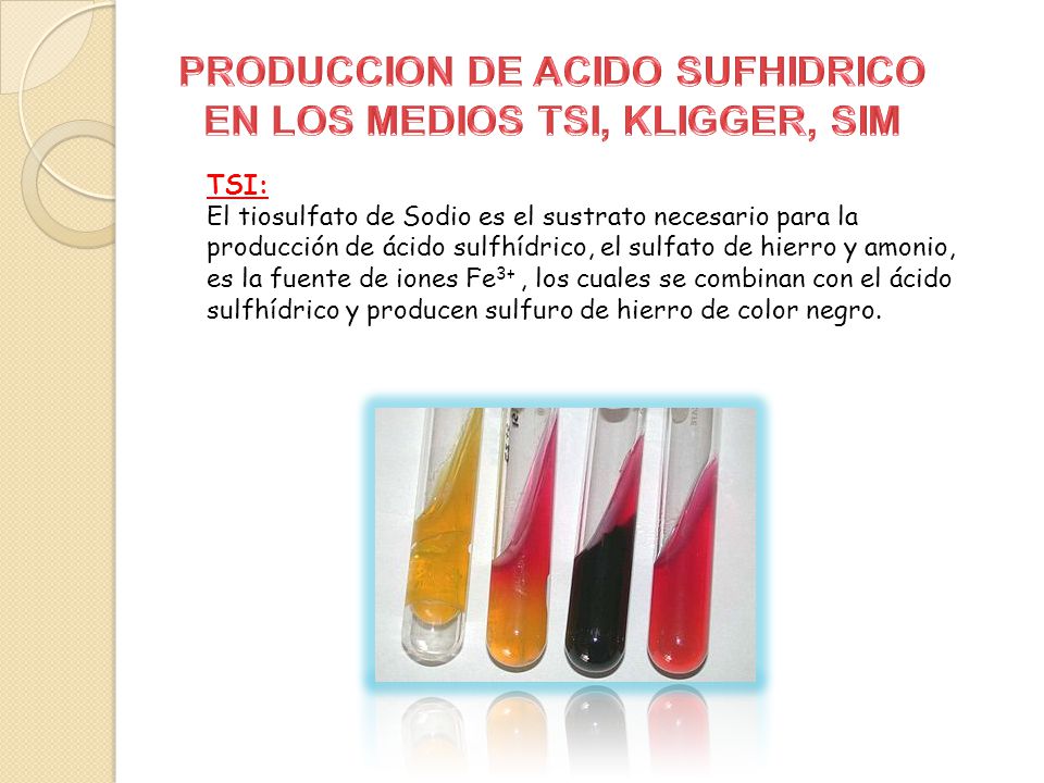 PRODUCCION DE ACIDO SUFHIDRICO EN LOS MEDIOS TSI, KLIGGER, SIM