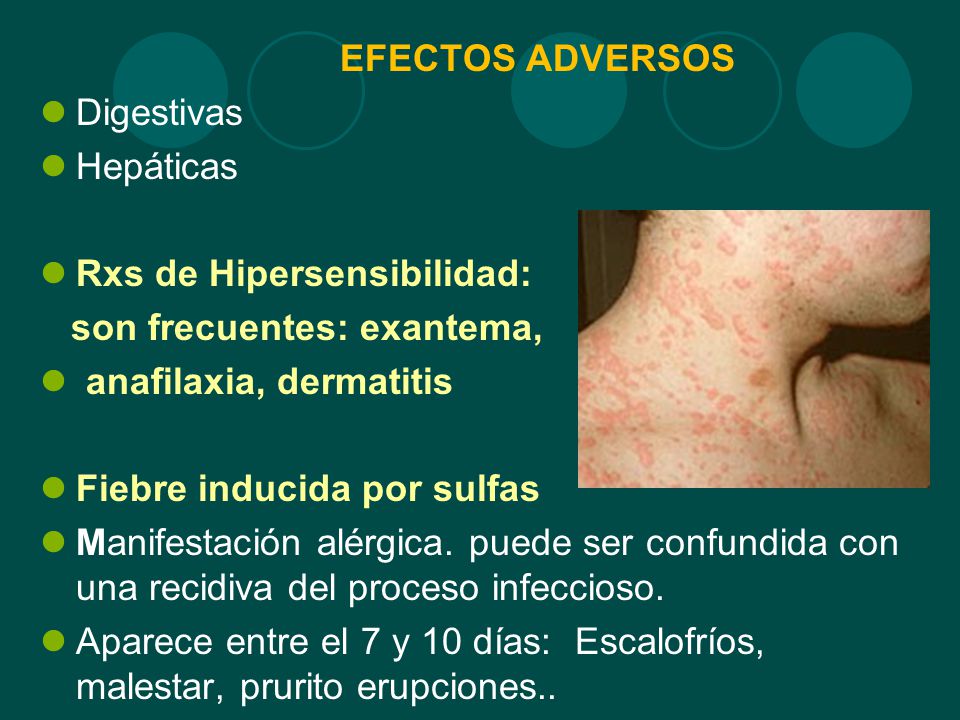 EFECTOS ADVERSOS Digestivas. Hepáticas. Rxs de Hipersensibilidad: son frecuentes: exantema, anafilaxia, dermatitis.