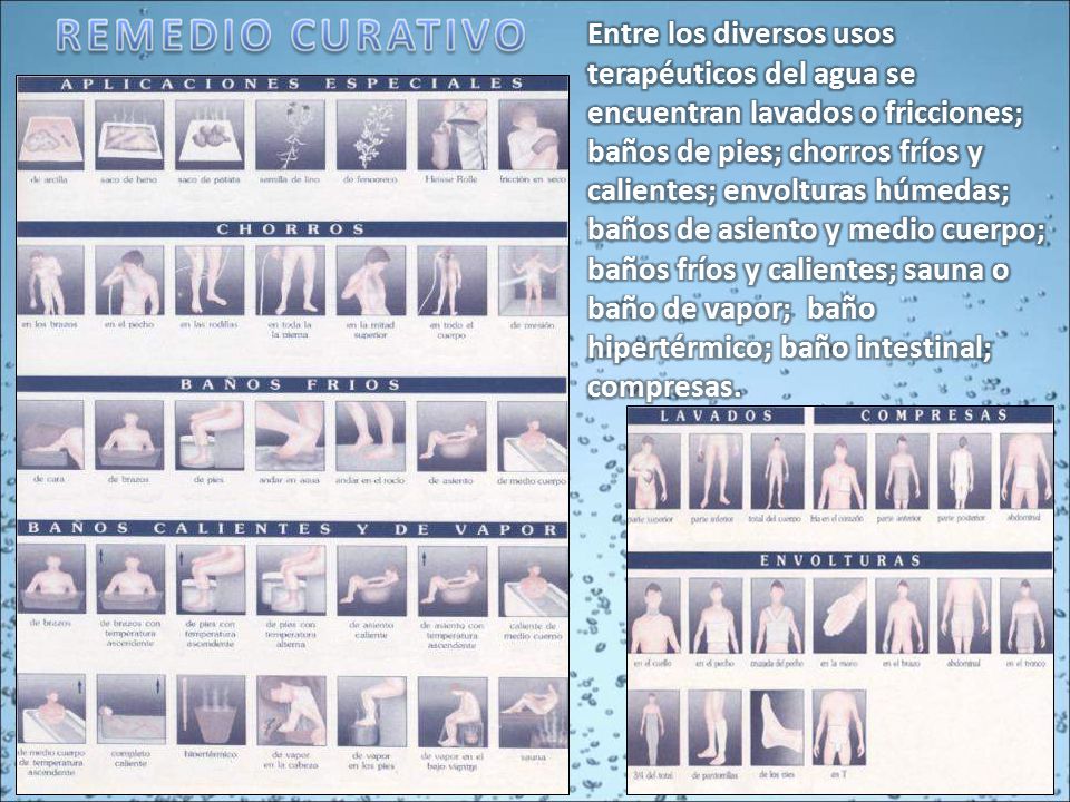Entre los diversos usos terapéuticos del agua se encuentran lavados o fricciones; baños de pies; chorros fríos y calientes; envolturas húmedas; baños de asiento y medio cuerpo; baños fríos y calientes; sauna o baño de vapor; baño hipertérmico; baño intestinal; compresas.