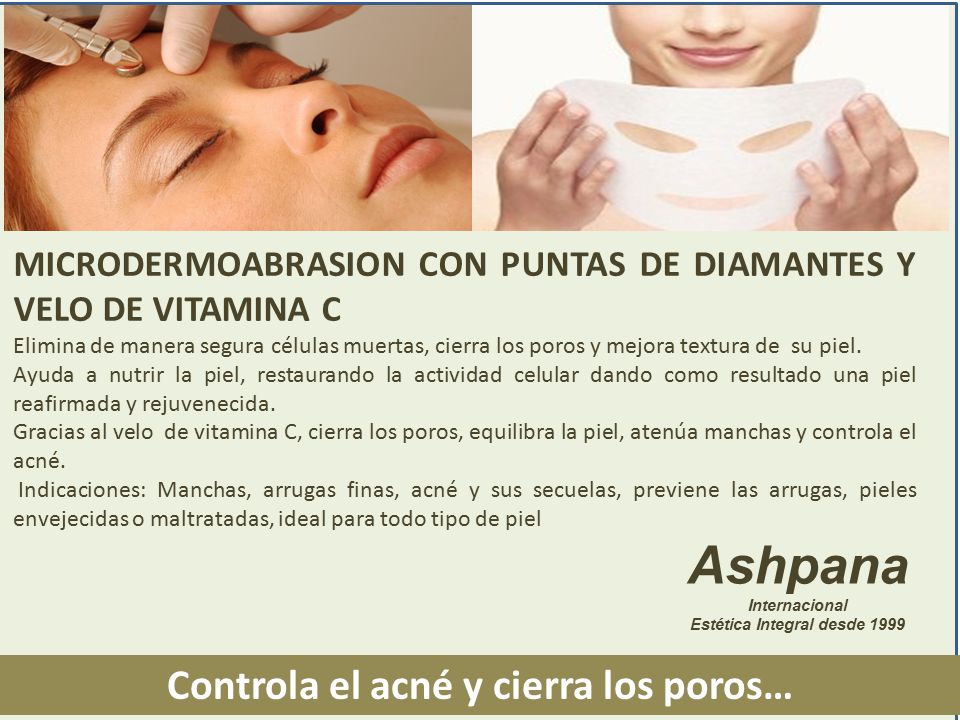 Estética Integral desde 1999 Controla el acné y cierra los poros…