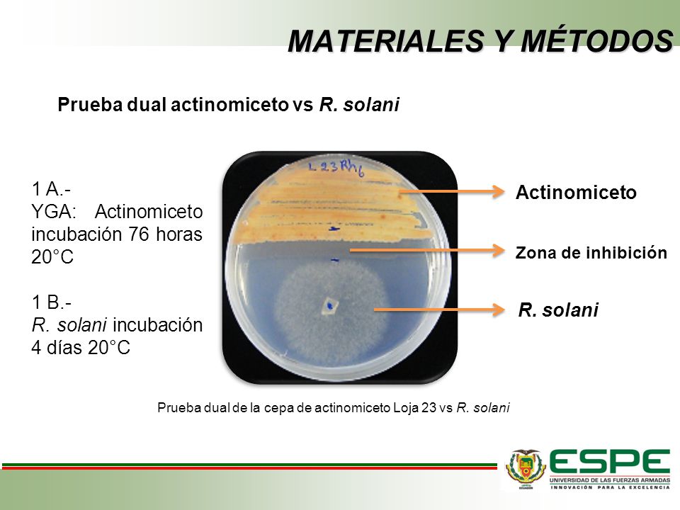 MATERIALES Y MÉTODOS Prueba dual actinomiceto vs R. solani 1 A.-