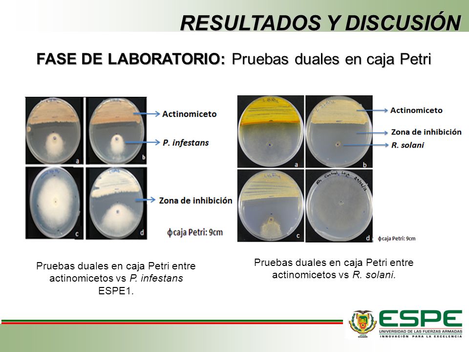 Pruebas duales en caja Petri entre actinomicetos vs R. solani.