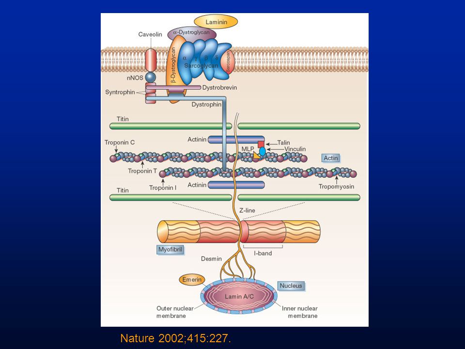 Figure 2 Proteins and pathways involved in the development of cardiomyopathies. Identified genes that result in dilated cardiomyopathy include the cytoskeletal protein-encoding genes - and -sarcoglycan in the sarcolemma, dystrophin and the intermediate filament protein-encoding genes desmin and lamin A/C. Sarcomeric protein-encoding genes actin, -myosin heavy chain, -tropomyosin and cardiac troponin T cause either dilated cardiomyopathy or hypertrophic cardiomyopathy, whereas cardiac troponin I, titin and the myosin light chains cause hypertrophic cardiomyopathy. Mutations in -dystrobrevin cause the intermediate phenotype, left ventricular noncompaction. MLP, muscle LIM protein; nNOS, neuronal nitric oxide synthase