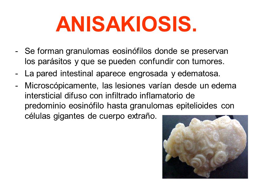 Se forman granulomas eosinófilos donde se preservan los parásitos y que se pueden confundir con tumores.