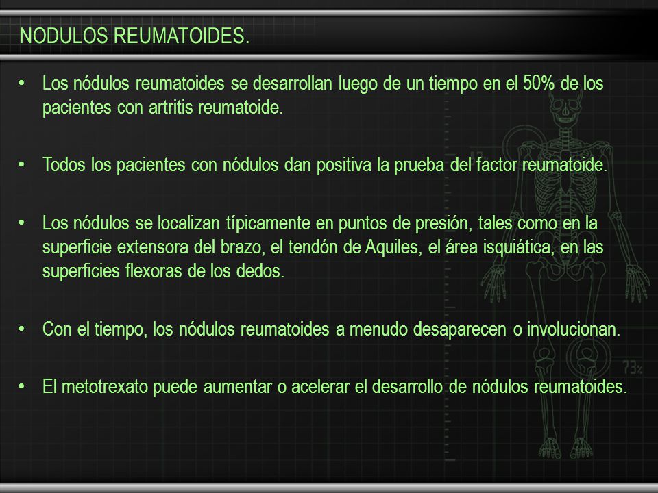 NODULOS REUMATOIDES. Los nódulos reumatoides se desarrollan luego de un tiempo en el 50% de los pacientes con artritis reumatoide.