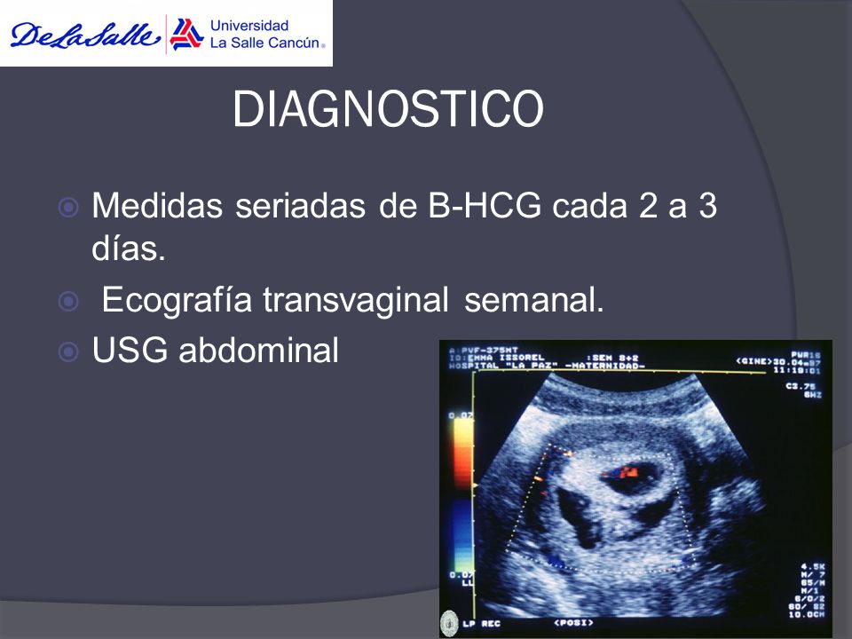 DIAGNOSTICO Medidas seriadas de B-HCG cada 2 a 3 días.