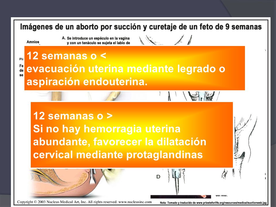 12 semanas o < evacuación uterina mediante legrado o. aspiración endouterina. 12 semanas o > Si no hay hemorragia uterina.
