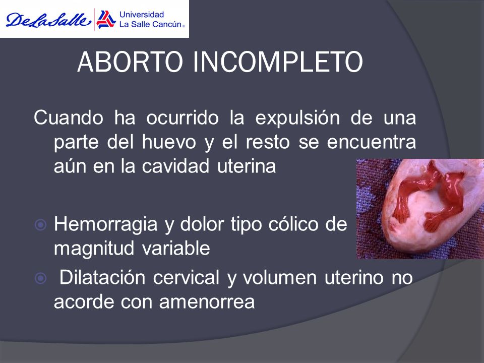 ABORTO INCOMPLETO Cuando ha ocurrido la expulsión de una parte del huevo y el resto se encuentra aún en la cavidad uterina.