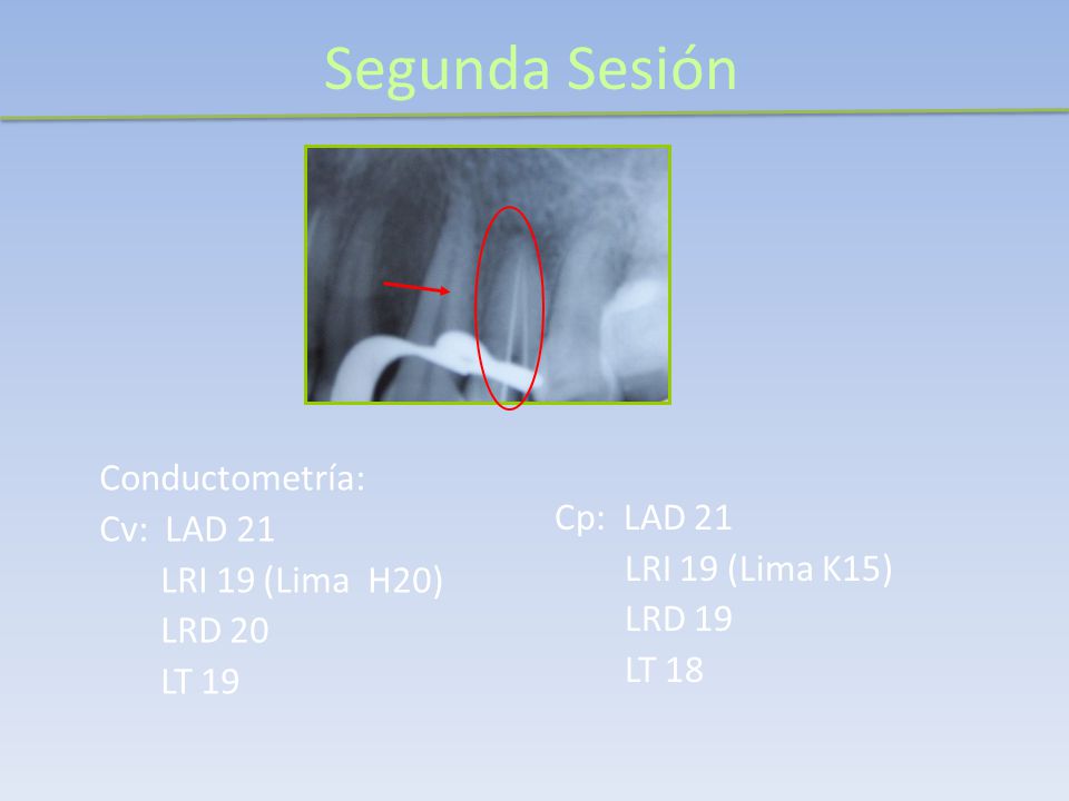 Segunda Sesión Conductometría: Cp: LAD 21 Cv: LAD 21 LRI 19 (Lima K15)