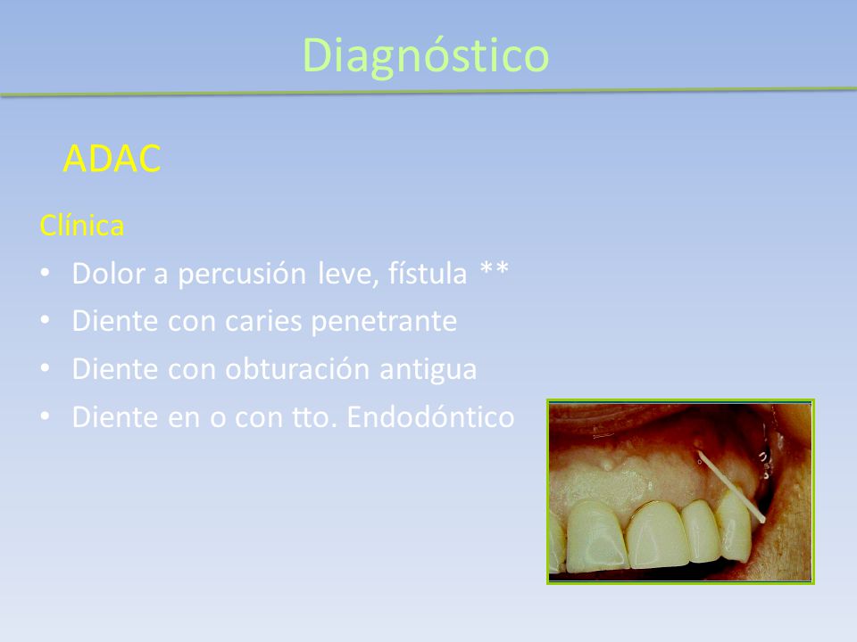 Diagnóstico ADAC Clínica Dolor a percusión leve, fístula **