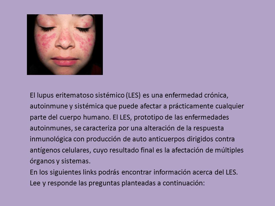 El lupus eritematoso sistémico (LES) es una enfermedad crónica, autoinmune y sistémica que puede afectar a prácticamente cualquier parte del cuerpo humano. El LES, prototipo de las enfermedades autoinmunes, se caracteriza por una alteración de la respuesta inmunológica con producción de auto anticuerpos dirigidos contra antígenos celulares, cuyo resultado final es la afectación de múltiples órganos y sistemas.
