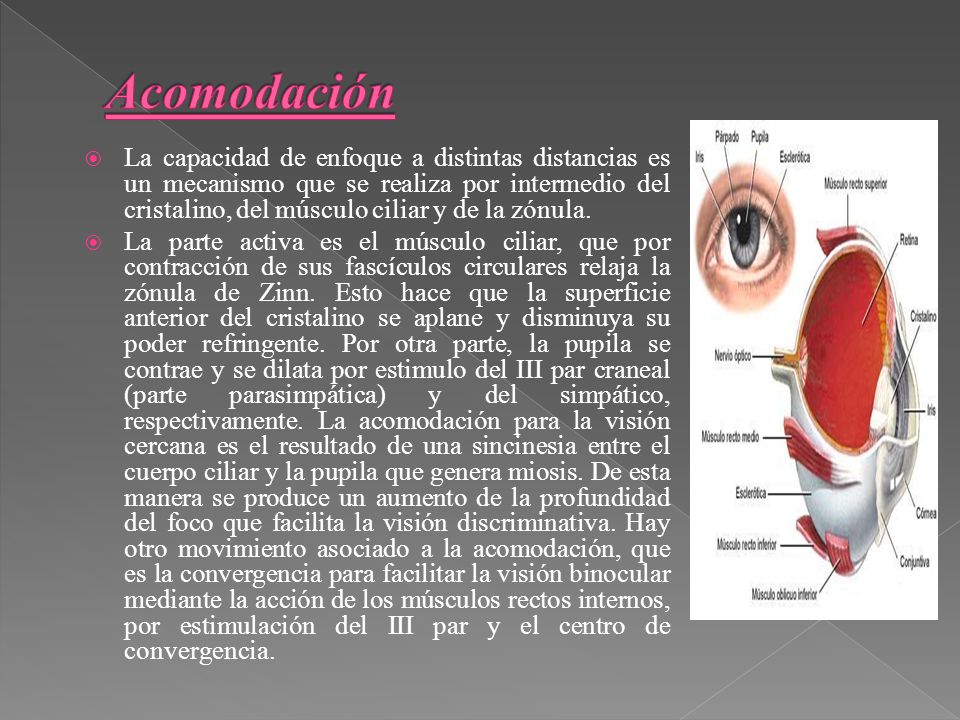 Acomodación
