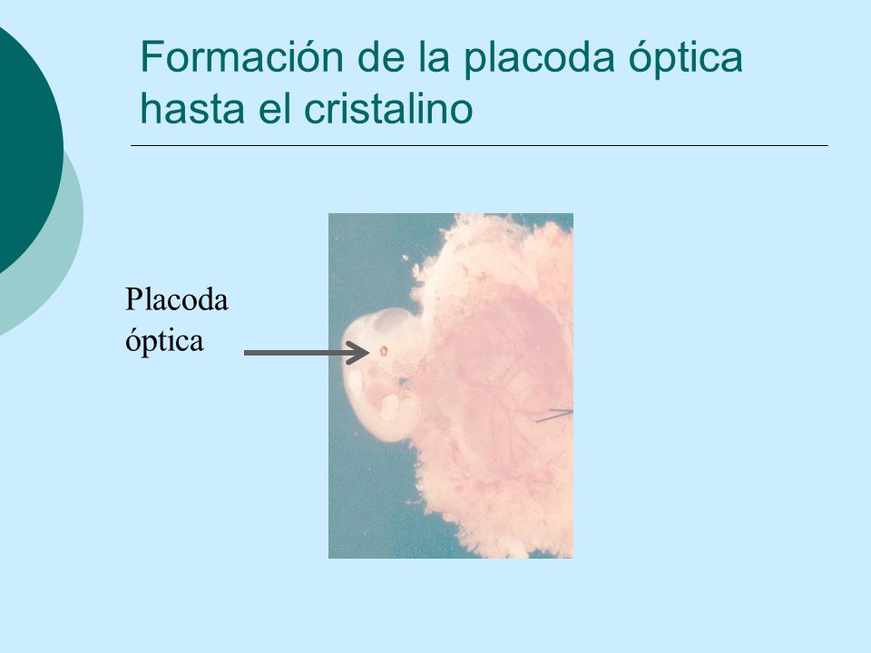 Formación de la placoda óptica hasta el cristalino