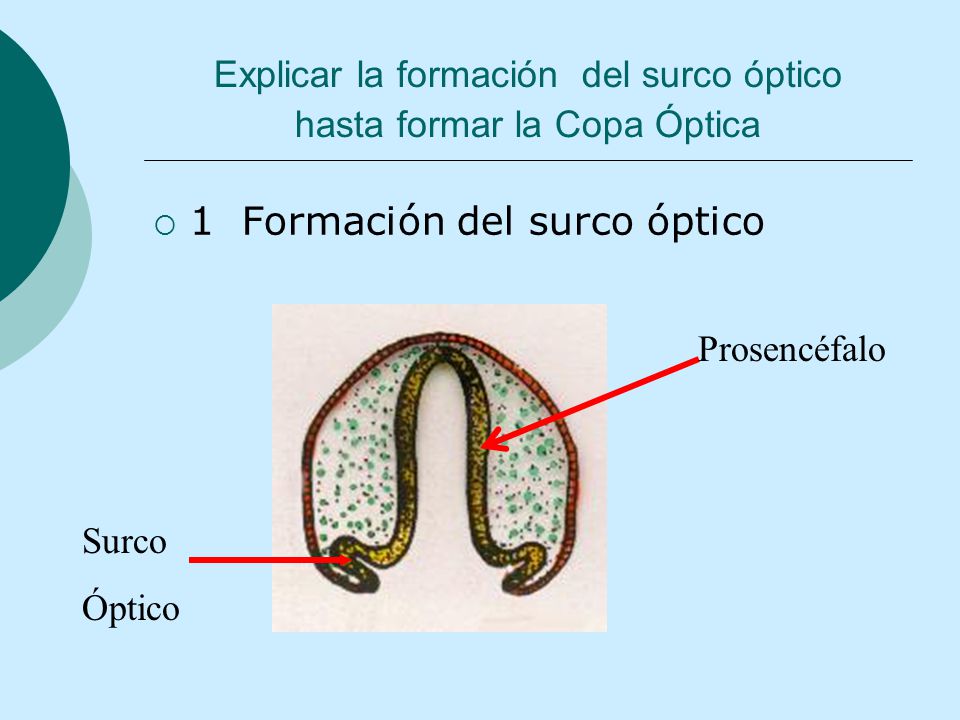 Explicar la formación del surco óptico hasta formar la Copa Óptica