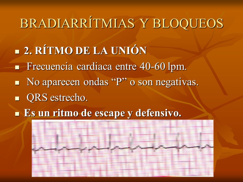 BRADIARRÍTMIAS Y BLOQUEOS