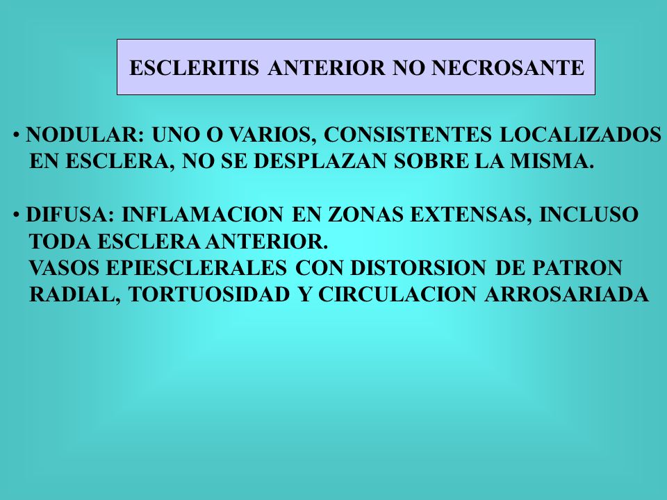 ESCLERITIS ANTERIOR NO NECROSANTE