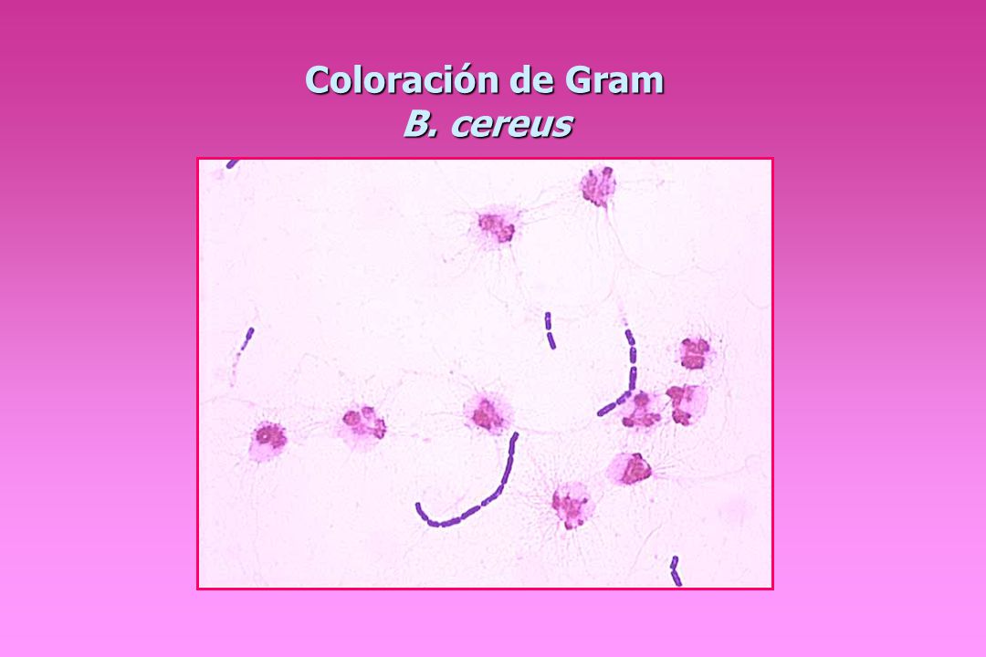 Coloración de Gram B. cereus