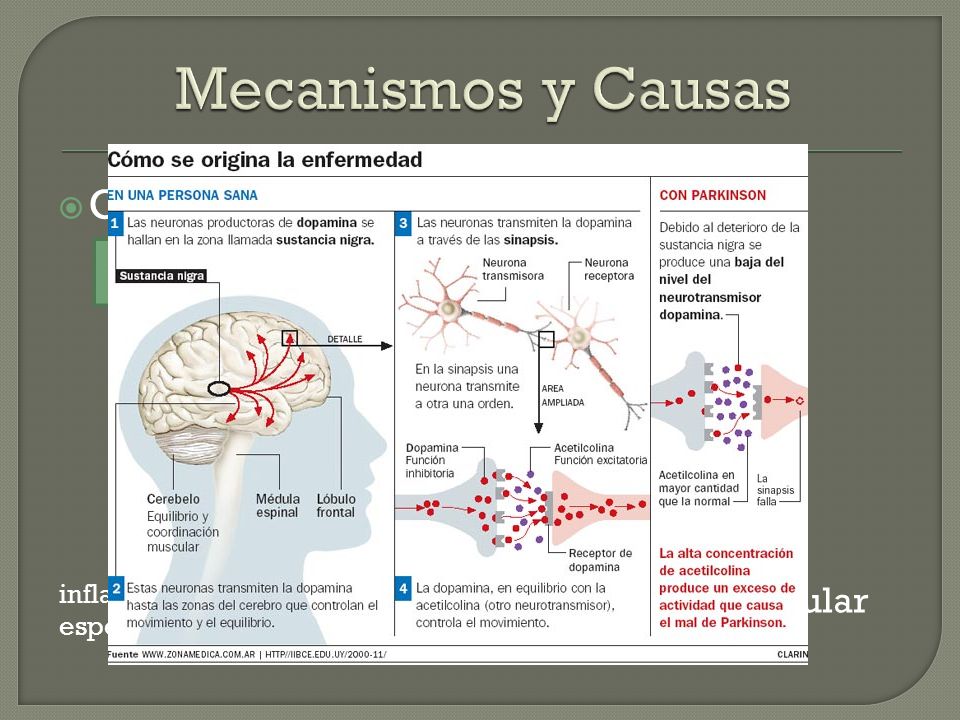 Mecanismos y Causas Captura defectuosa de dopamina Daño celular