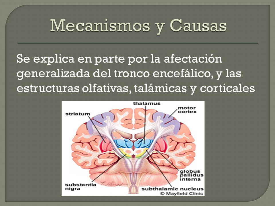 Mecanismos y Causas Se explica en parte por la afectación generalizada del tronco encefálico, y las estructuras olfativas, talámicas y corticales.