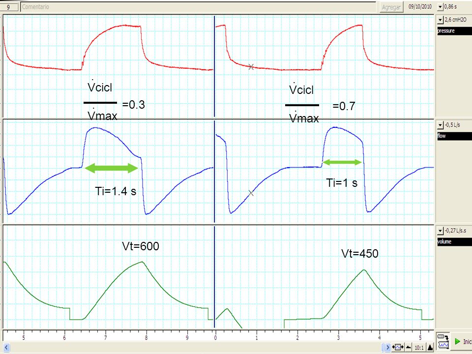 . . Vcicl Vmax Vcicl Vmax . =0.3 . =0.7 Ti=1 s Ti=1.4 s Vt=600 Vt=450