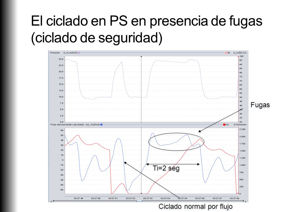 El ciclado en PS en presencia de fugas (ciclado de seguridad)