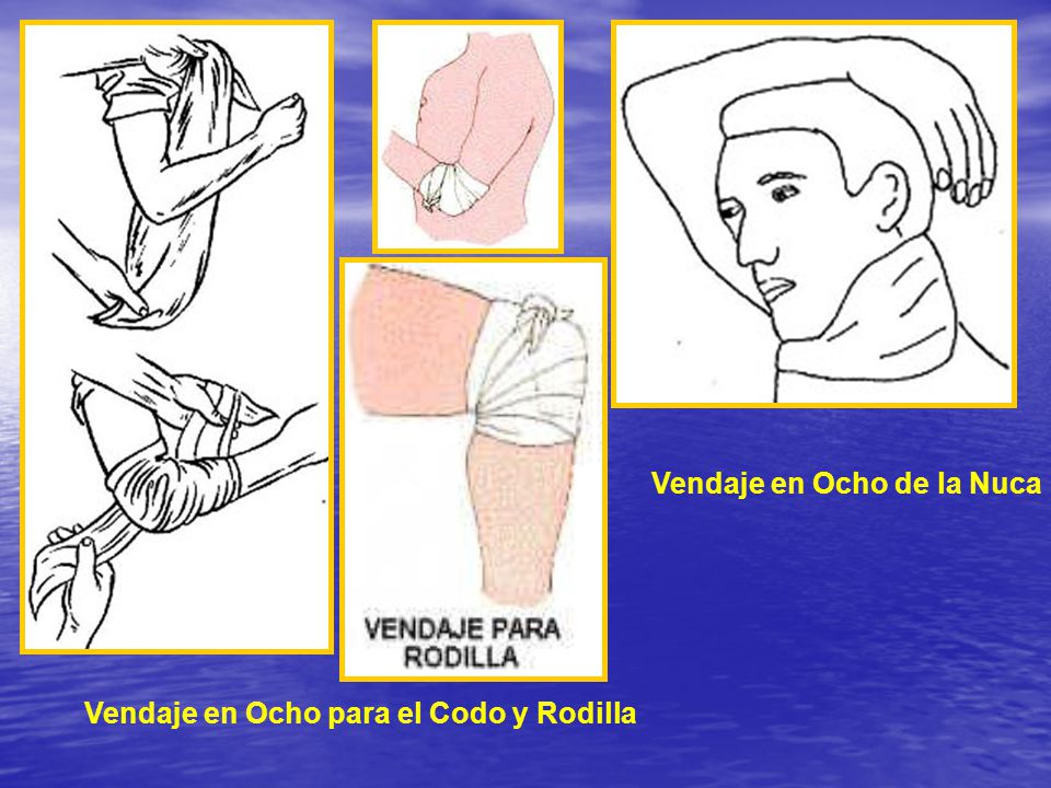 Vendaje en Ocho de la Nuca Vendaje en Ocho para el Codo y Rodilla
