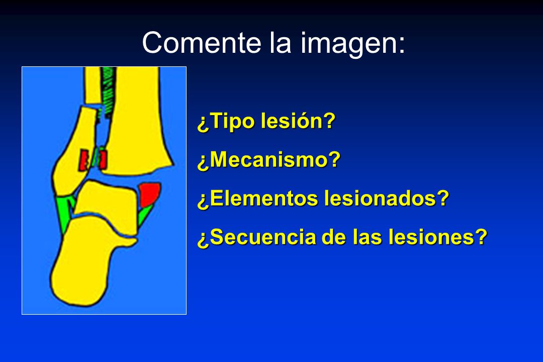 Comente la imagen: ¿Tipo lesión ¿Mecanismo ¿Elementos lesionados