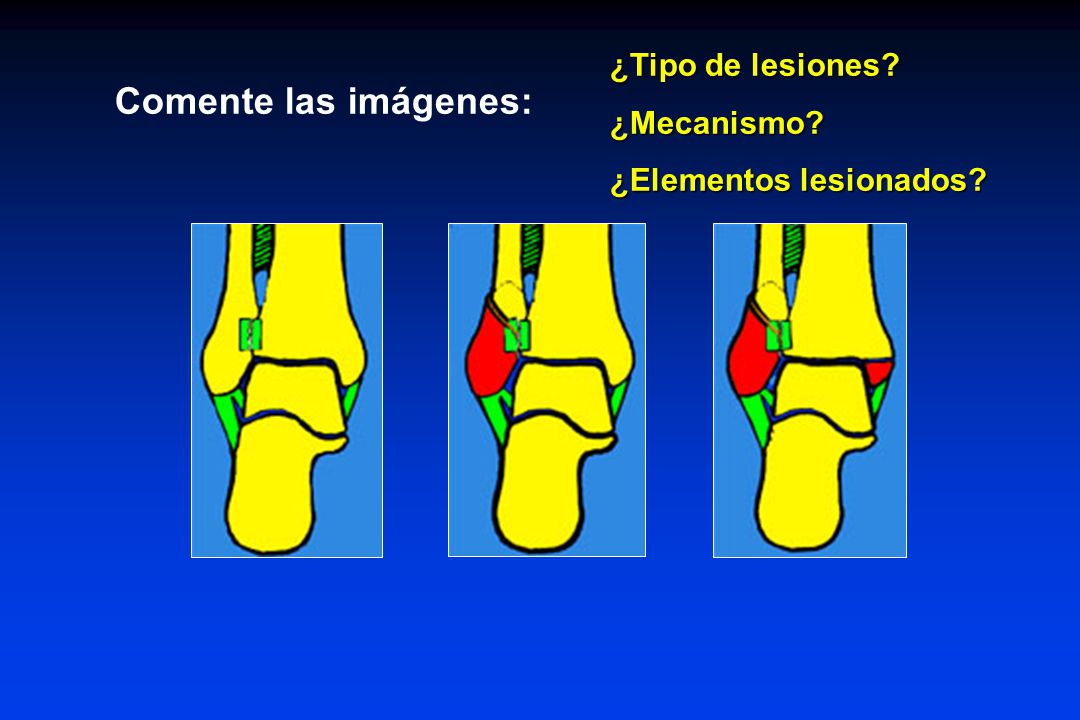 Comente las imágenes: ¿Tipo de lesiones ¿Mecanismo