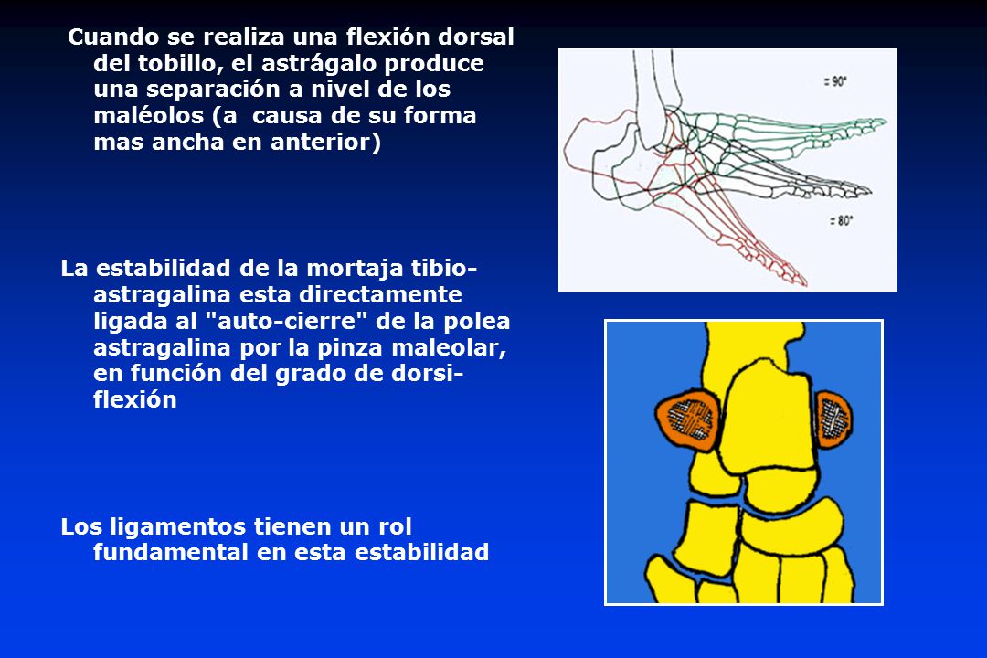 Cuando se realiza una flexión dorsal del tobillo, el astrágalo produce una separación a nivel de los maléolos (a causa de su forma mas ancha en anterior)