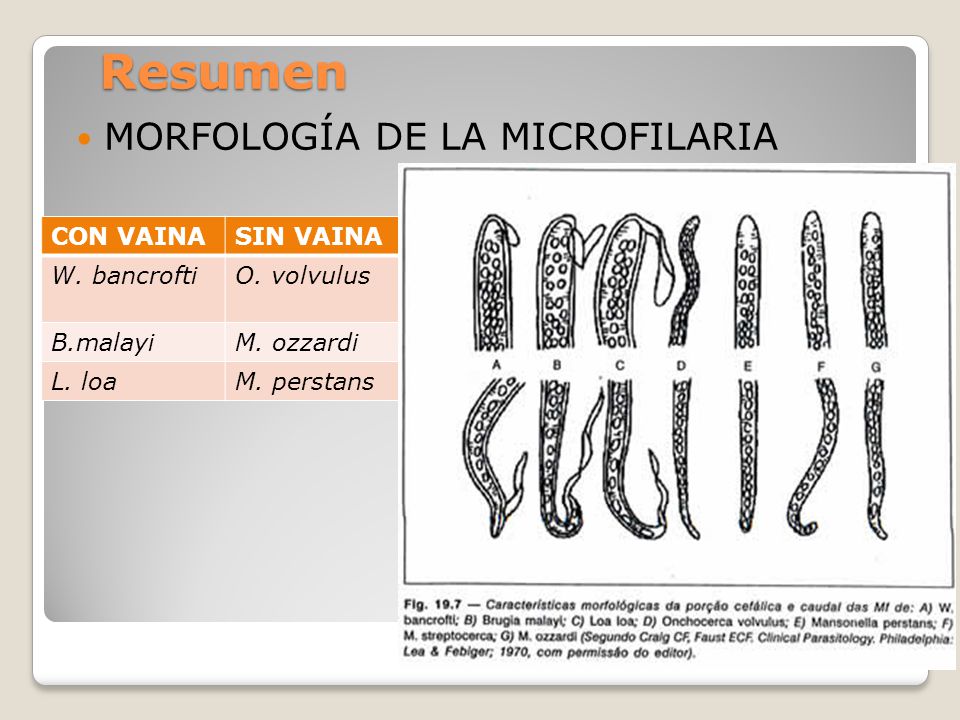 Resumen MORFOLOGÍA DE LA MICROFILARIA CON VAINA SIN VAINA W. bancrofti