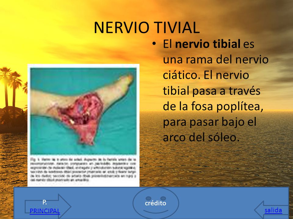 NERVIO TIVIAL El nervio tibial es una rama del nervio ciático. El nervio tibial pasa a través de la fosa poplítea, para pasar bajo el arco del sóleo.