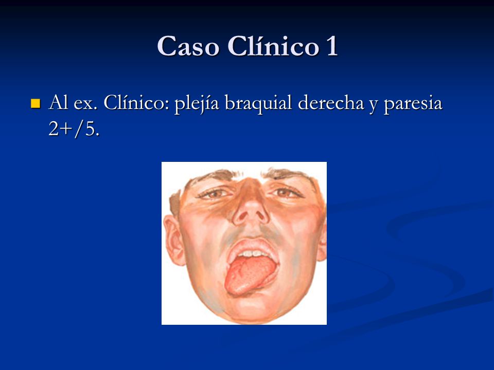 Caso Clínico 1 Al ex. Clínico: plejía braquial derecha y paresia 2+/5.