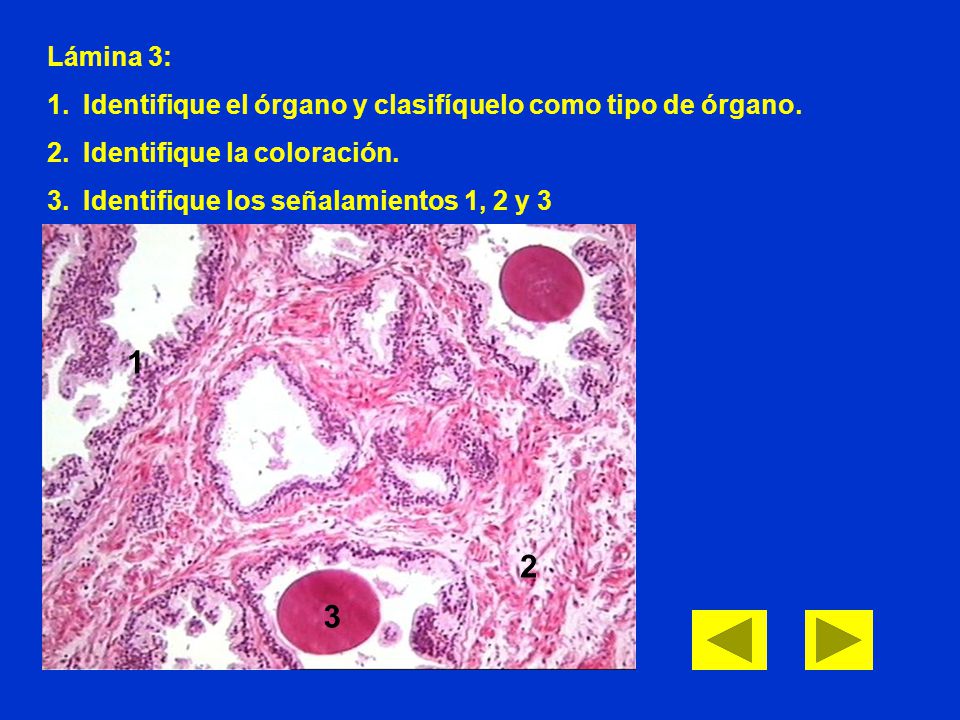 Lámina 3: Identifique el órgano y clasifíquelo como tipo de órgano. Identifique la coloración. Identifique los señalamientos 1, 2 y 3.