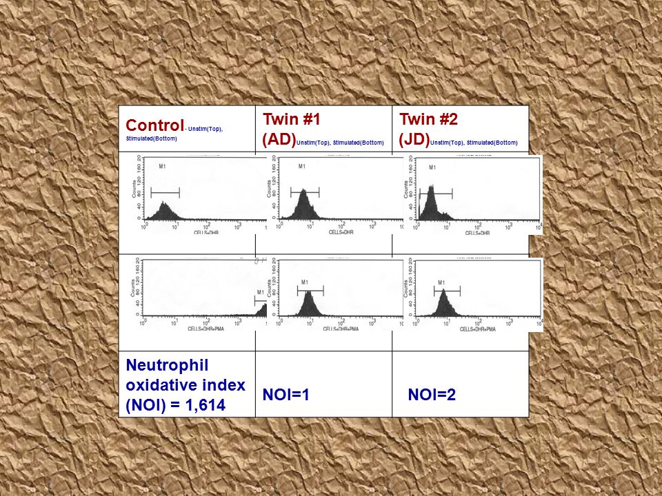 Control- Unstim(Top), Stimulated(Bottom) Twin #1 (AD)Unstim(Top), Stimulated(Bottom) Twin #2 (JD)Unstim(Top), Stimulated(Bottom)