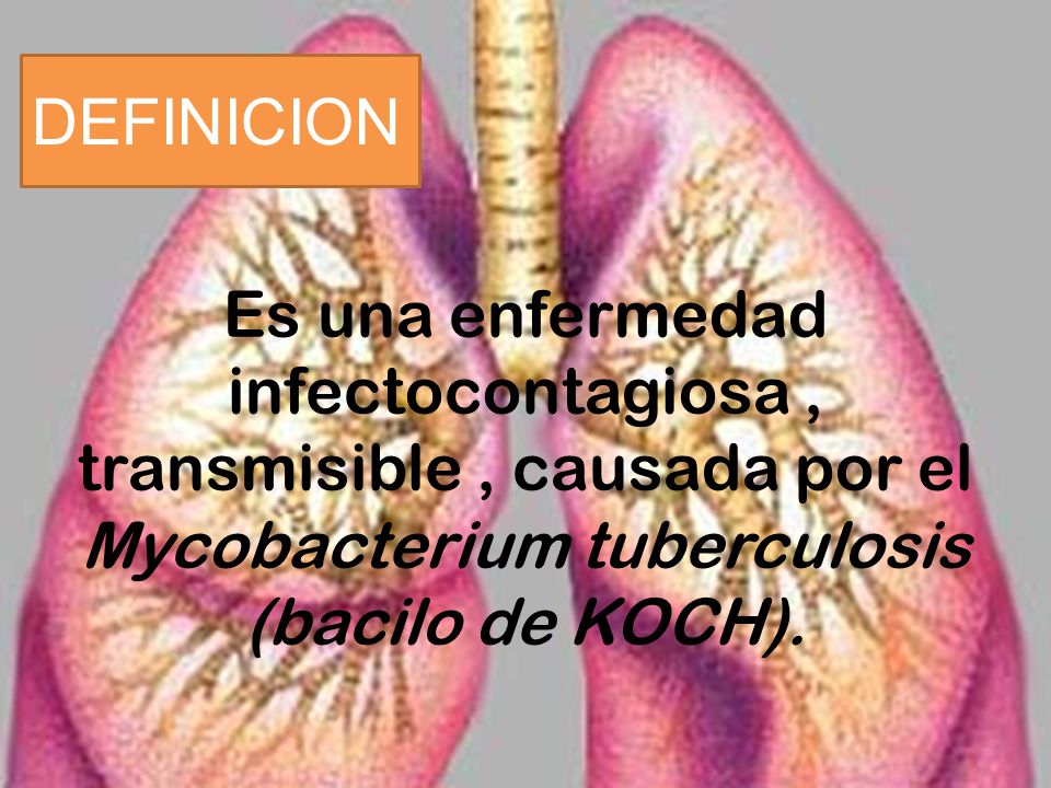 DEFINICION Es una enfermedad infectocontagiosa , transmisible , causada por el Mycobacterium tuberculosis (bacilo de KOCH).